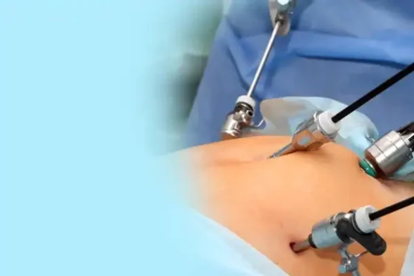laparoscopic surgery